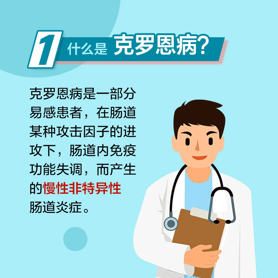 克罗恩病线样征x图片-克罗恩病线样征：肠道的无声战斗与身心折磨